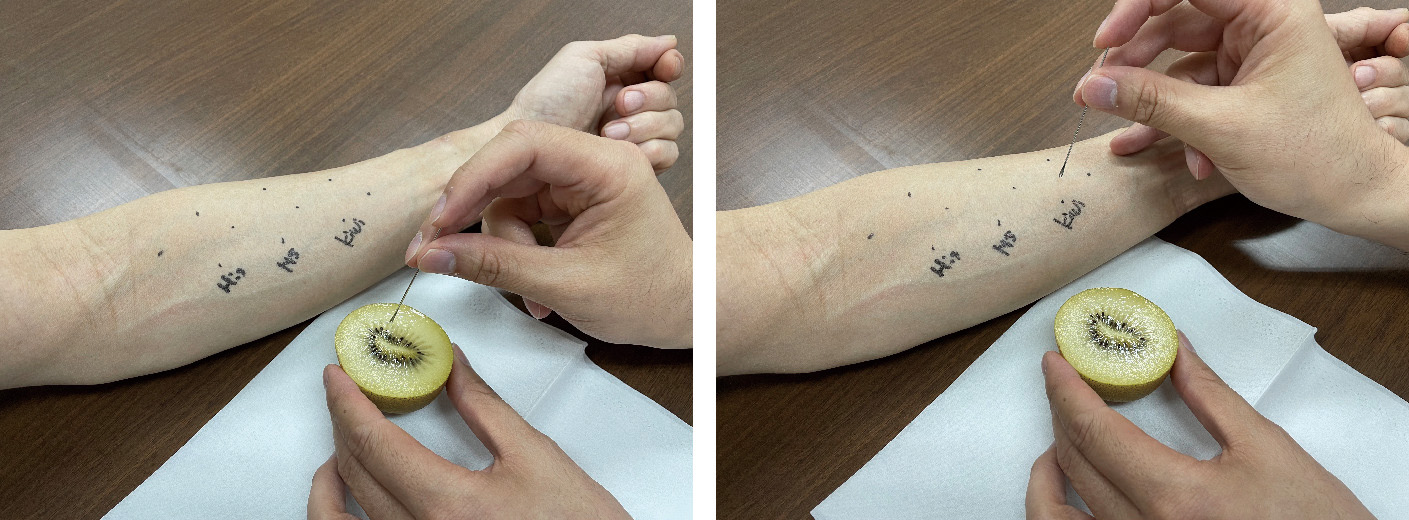 図1　プリック–プリックテスト． 