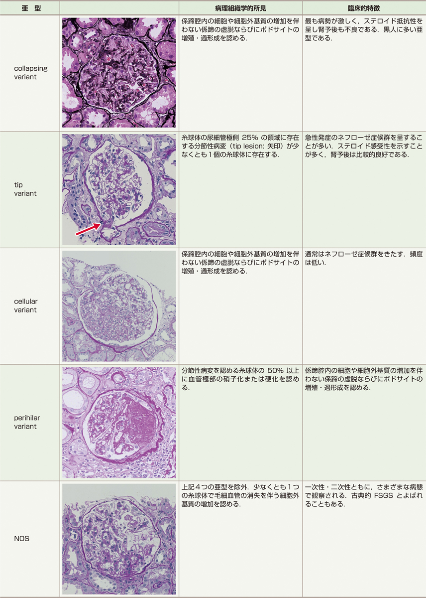 表1　前弯負荷試験． 