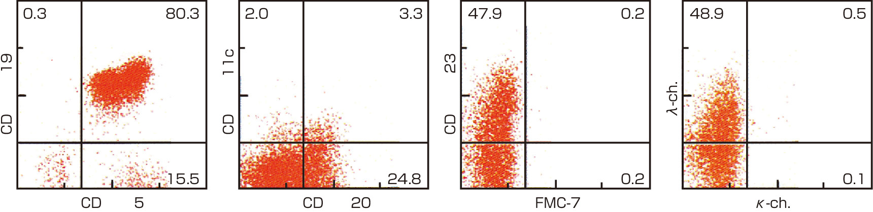 図2　フローサイトメトリーによるCLLのマーカー解析． CLLでは，B細胞抗原であるCD19は強陽性で，CD5，CD23も陽性である．一方B細胞受容体関連抗原のCD20や表面免疫グロブリン (本例では λ) の発現は弱いのが特徴である．