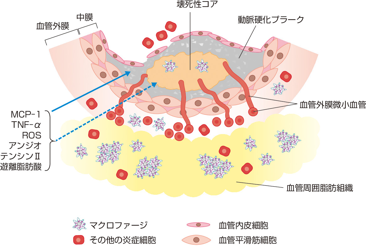 図1　血管周囲脂肪組織と動脈硬化病変の関係 (Tanaka K, Sata M: Front Physiol, 2018; 9: 3より作成)． 動脈硬化病変の血管周囲脂肪組織はサイトカインやその他の血管調節因子を分泌し，隣接する血管に直接または血管外膜微小血管を介して作用し，動脈硬化病変形成に影響を及ぼす．