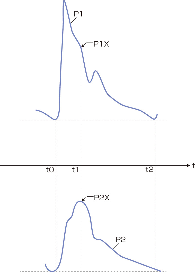 図1　中心血圧の推定． 末梢動脈脈波P1と大動脈脈波P2とを用いて中心血圧を推定する．まず，大動脈脈波P2のタイダルウェーブ (主ピーク) P2Xを検出する．次に，タイダルウェーブ (主ピーク) P2Xが検出された時点t1の末梢動脈脈波P1の振幅 (血圧に相当) を中心血圧と推定する．これにより中心血圧を知ることができる．