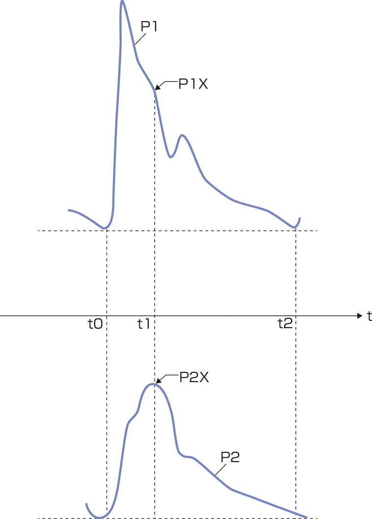 図1　中心血圧の推定． 末梢動脈脈波P1と大動脈脈波P2とを用いて中心血圧を推定する．まず，大動脈脈波P2のタイダルウェーブ (主ピーク) P2Xを検出する．次に，タイダルウェーブ (主ピーク) P2Xが検出された時点t1の末梢動脈脈波P1の振幅 (血圧に相当) を中心血圧と推定する．これにより中心血圧を知ることができる．