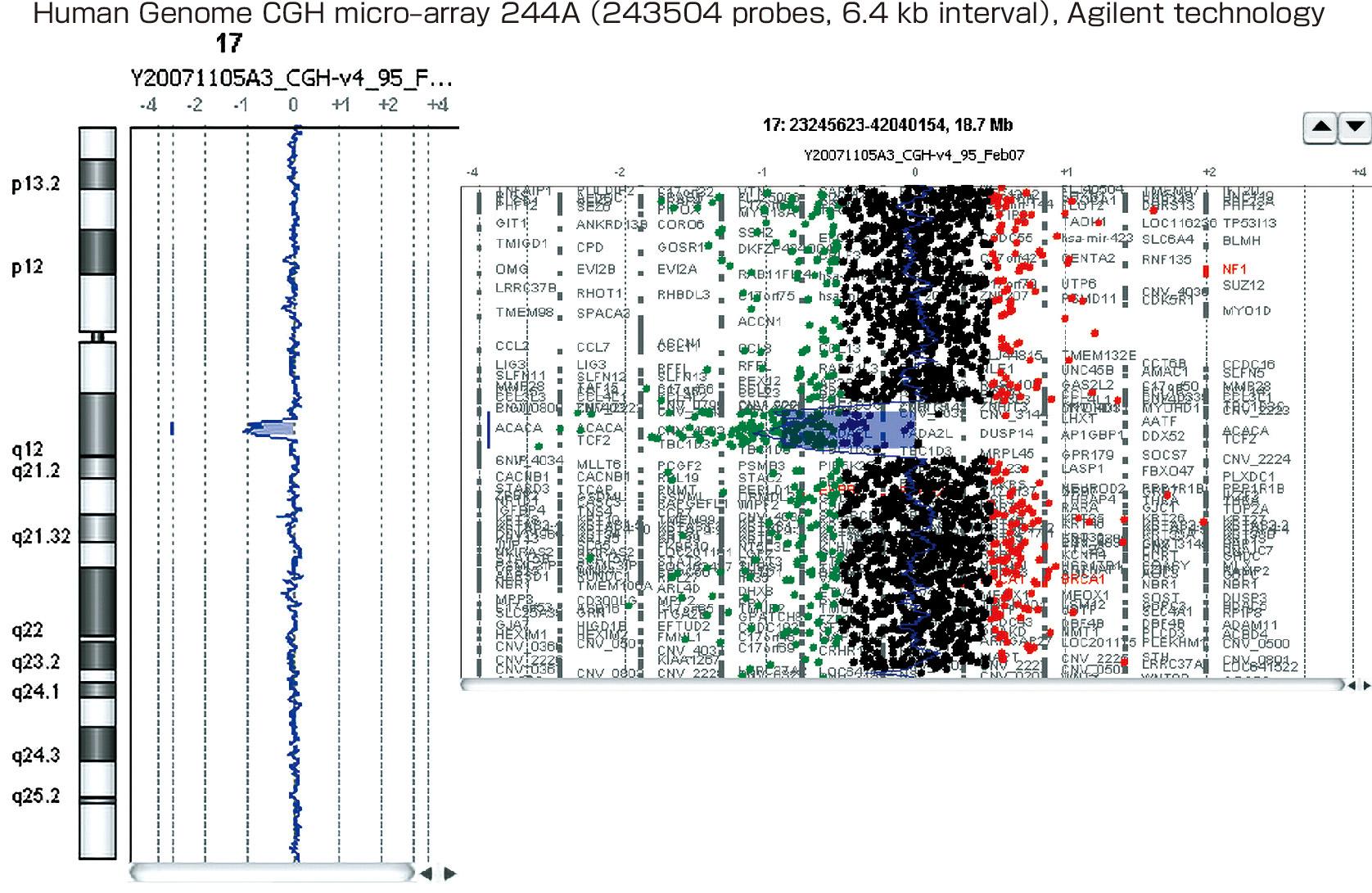 ⓔ図1-4-1　アレイCGH (Iwasaki N, Tsurumi M, et al: Hum Genome Var, 2016; 3: 16022) 若年発症成人型糖尿病 (maturity–onset diabetes of youth: MODY) 5症例のアレイCGHを示すMODY5患者に認められたHNF1b遺伝子を含む6.4 kbの欠失．