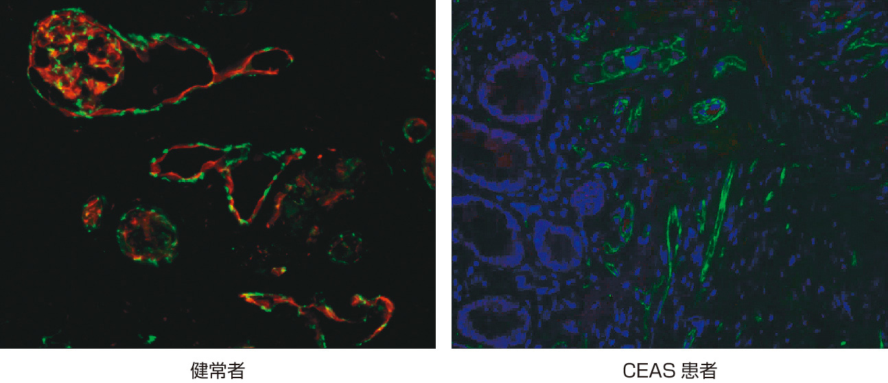 ⓔ図11-5-1　抗SLCO2A1抗体を用いた小腸粘膜生検組織の免疫組織化学 緑：VE–カドヘリン (血管内皮マーカー)，赤：SLCO2A1．