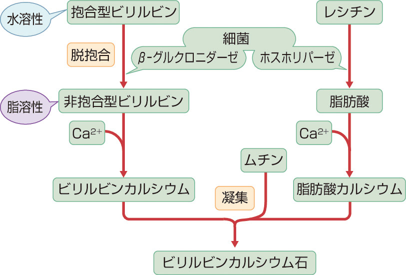 ⓔ図12-24-1　ビリルビンカルシウム石の形成機序 
