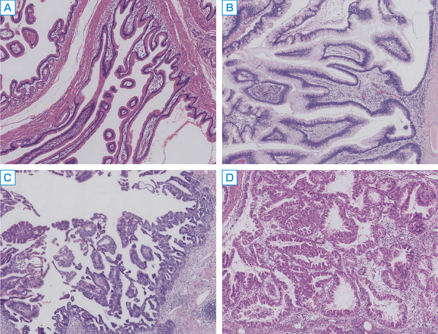ⓔ図12-29-8　IPMNの組織亜型 A：胃型IPMN，B：腸型IPMN，C：膵胆道型IPMN，D：オンコサイト型IPMN． ヘマトキシリン・エオジン染色．原図×100．