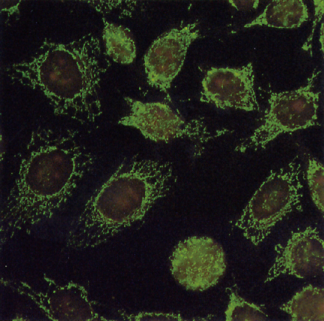 ⓔ図12-8-1　抗ミトコンドリア抗体 (間接蛍光抗体法) 