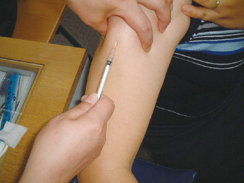 ⓔ図13-23-4　皮下免疫療法の実際 写真のようにアレルゲンを皮下注射する．増量期は1週間に1回，維持期は1カ月に1回，外来で行う．