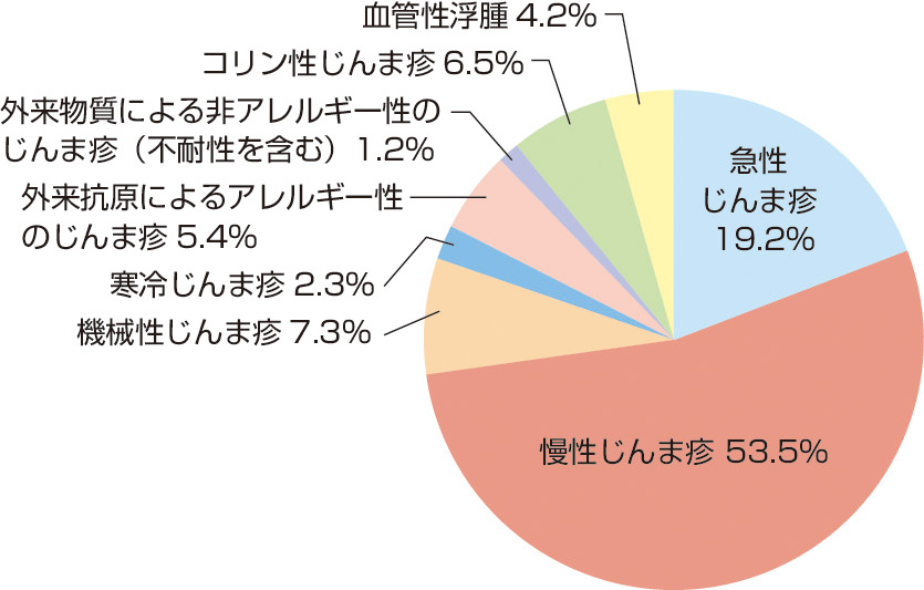 ⓔ図13-35-1　じんま疹の病型と患者数 (田中稔彦，他：広島大学皮膚科外来での蕁麻疹の病型別患者数．アレルギー，2006; 55: 134–139) 広島大学皮膚科を受診したじんま疹患者260人の病型別集計．