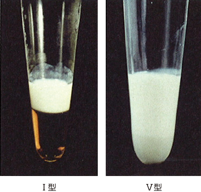 ⓔ図16-4-7　血清静置試験での血清外観 (村勢敏郎：高脂血症診療ガイド (第2版)，文光堂，2012) 