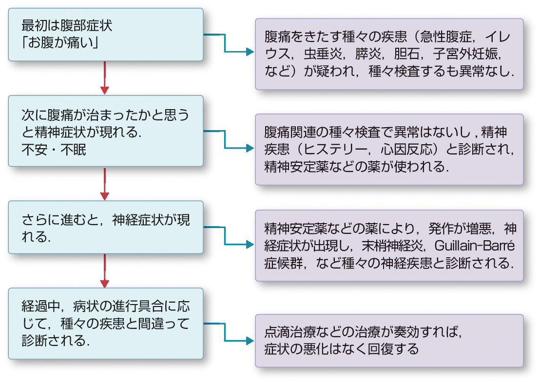ⓔ図16-6-1　急性ポルフィリン症の経過 典型例での症状の変化と，それに合わせた診断間違いの例．