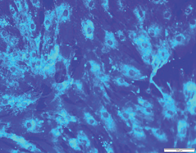 ⓔ図16-6-5　Niemann–Pick病C型 フィリピン染色画像．