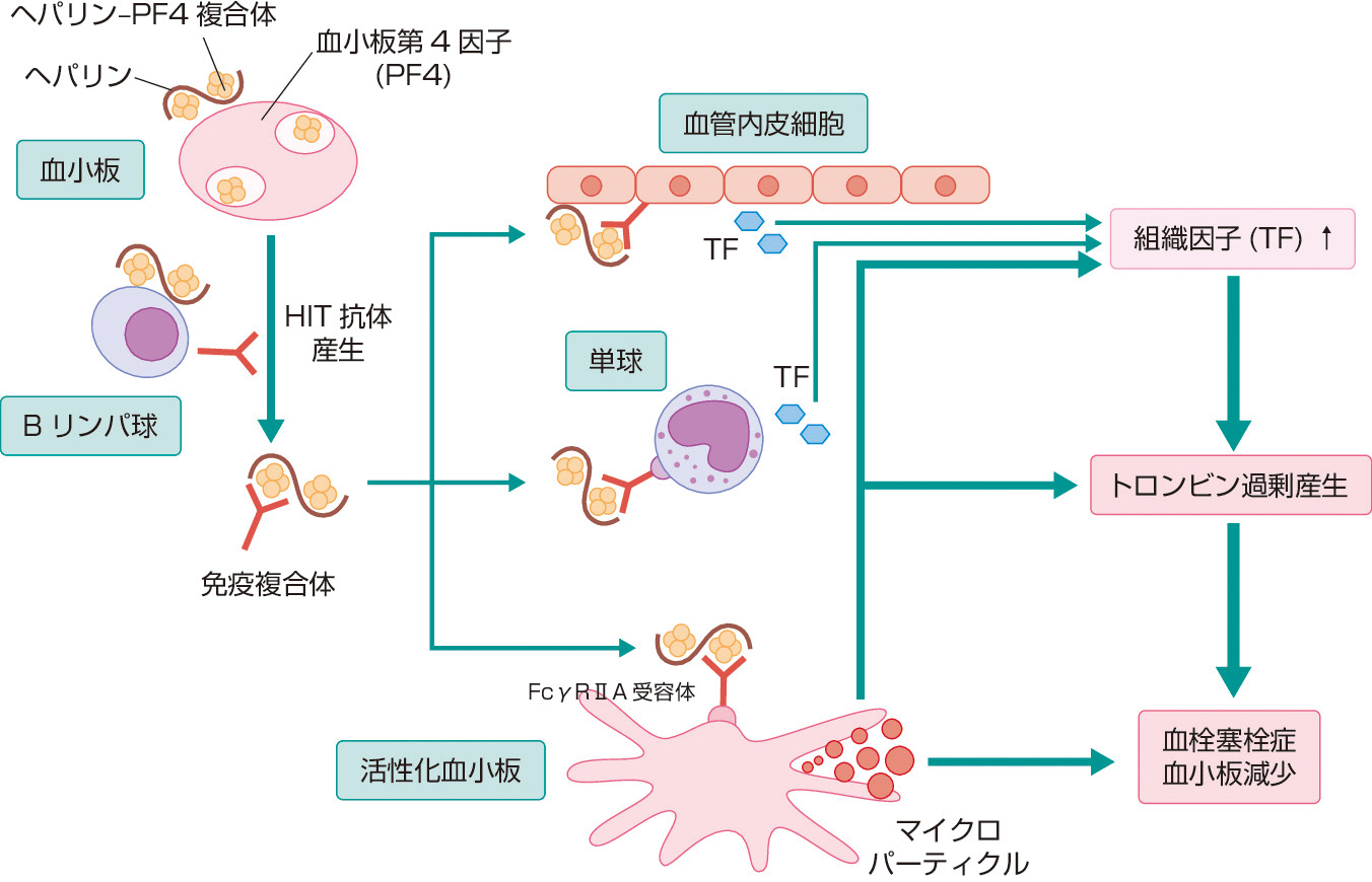 ⓔ図17-11-3　ヘパリン起因性血小板減少症の病態生理 