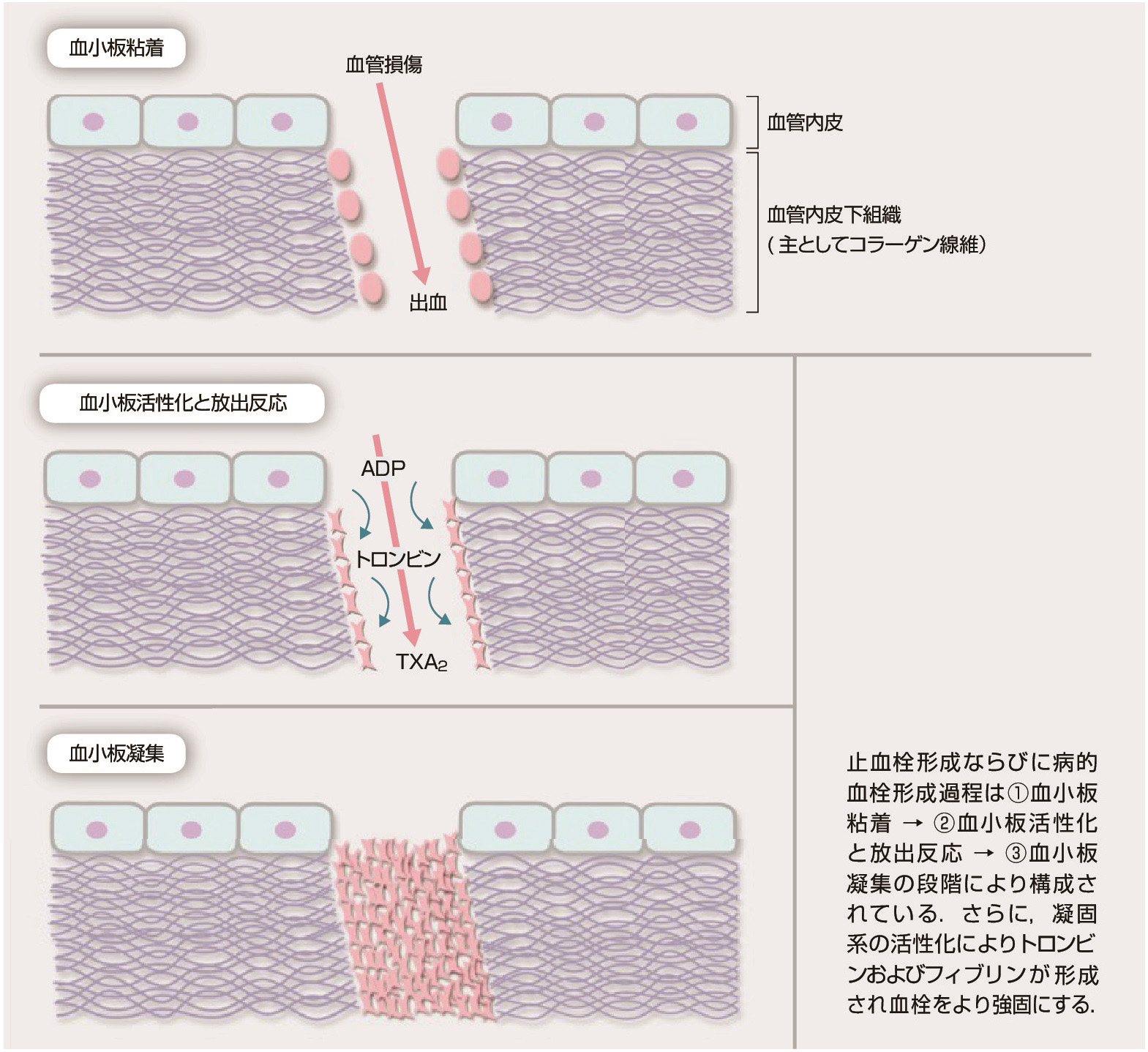 ⓔ図17-3-11　血栓形成過程 