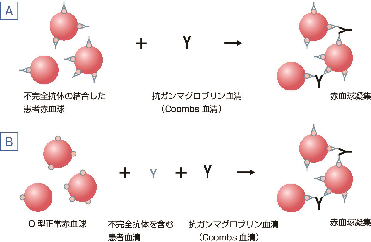 ⓔ図17-9-1　Coombs試験の原理 A：直接Coombs試験．B：間接Coombs試験