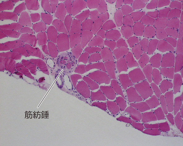 ⓔ図18-21-1　骨格筋内の筋紡錘 