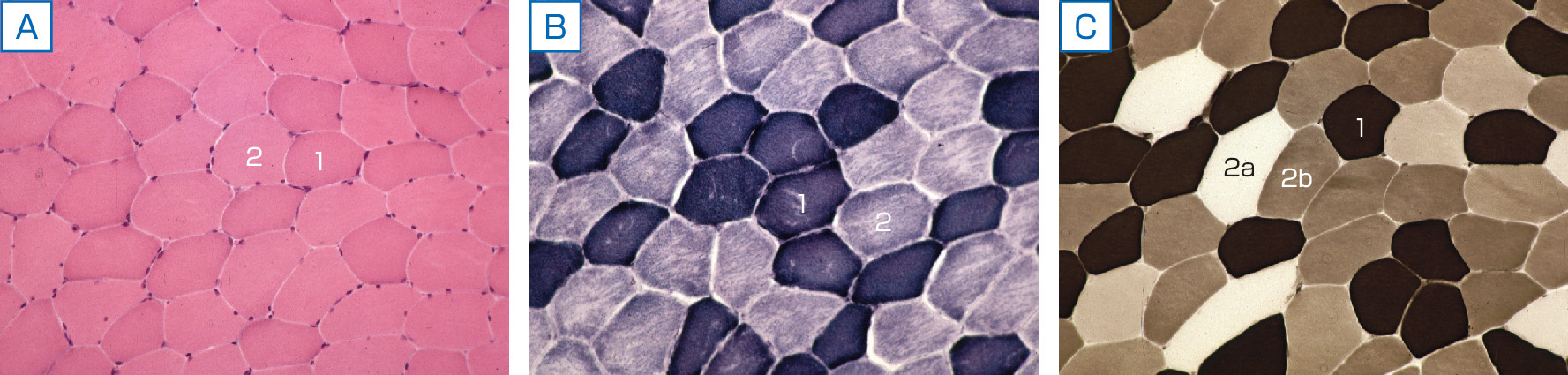 ⓔ図18-21-3　筋線維タイプ A：HE染色，B：NADH–TR，C：ATPase (pH4.6)．