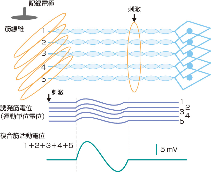 ⓔ図18-4-6　複合筋活動電位 (CMAP) 筋上の表面電極で記録される筋電位は，個々の神経が刺激されて誘発される筋電位の和として記録される．図では模式的に5本の神経線維が刺激された場合を示している．各神経の刺激で誘発された5つの運動単位電位の和が，この筋の複合筋活動電位となる．なお個々の運動単位電位は，神経末端の分枝により，数百本の筋線維の電位によって構成されている．