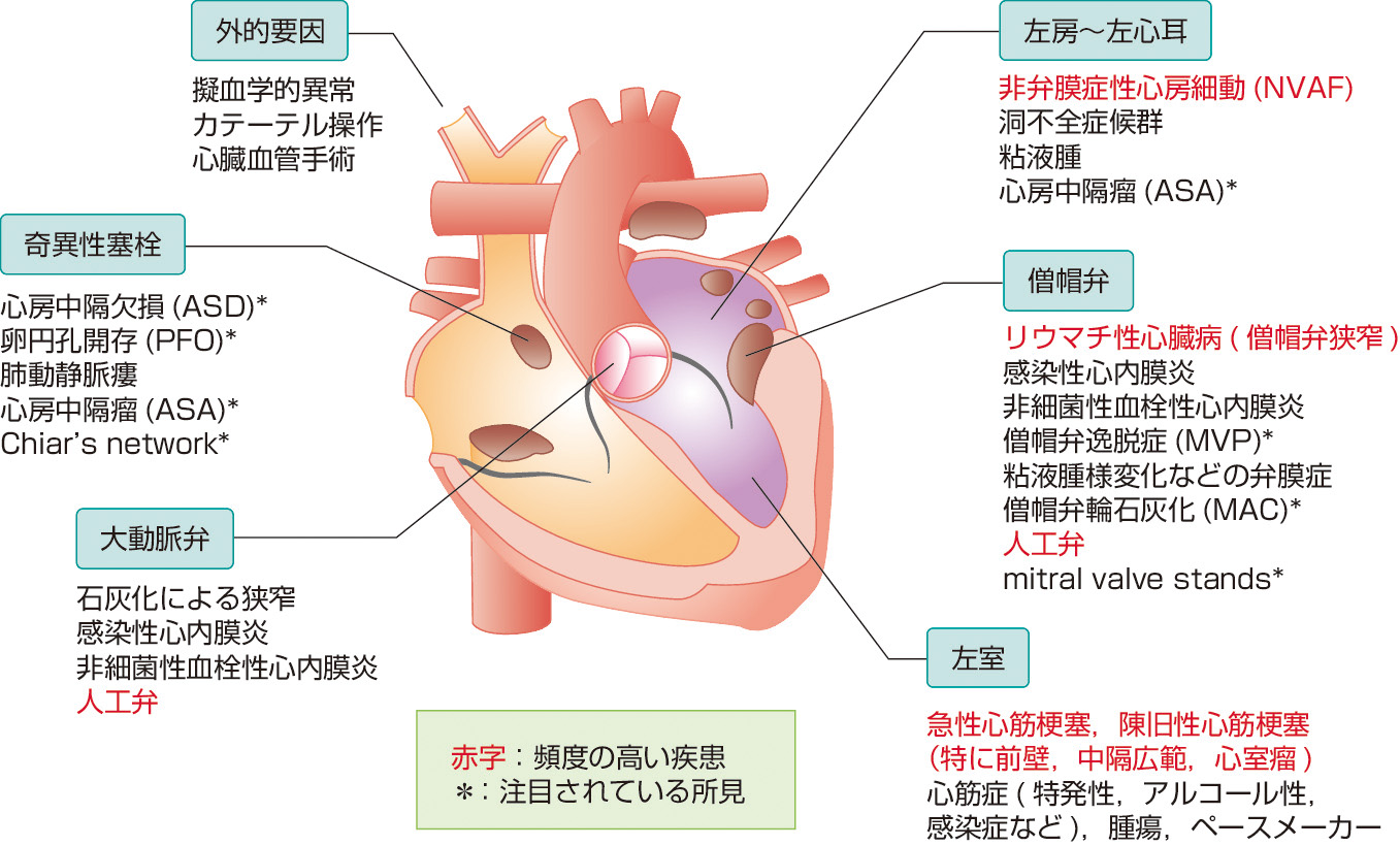 ⓔ図18-5-5　塞栓源となる心疾患 リウマチ性心臓病減少と高齢に伴いNVAFの占める頻度が高くなっている．