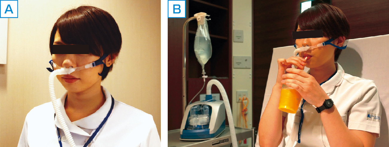 ⓔ図6-1-6　高流量鼻カニュラ (HFNC) 酸素療法 相対湿度100％まで加湿された最大60 L/分の高流量酸素空気混合ガスが加温回路を通してやや広径のシリコン製鼻カニュラから吸入される．FiO2は21％から100％まで設定できる．NPPVと比較して患者の快適性にすぐれ，QOLが高い．