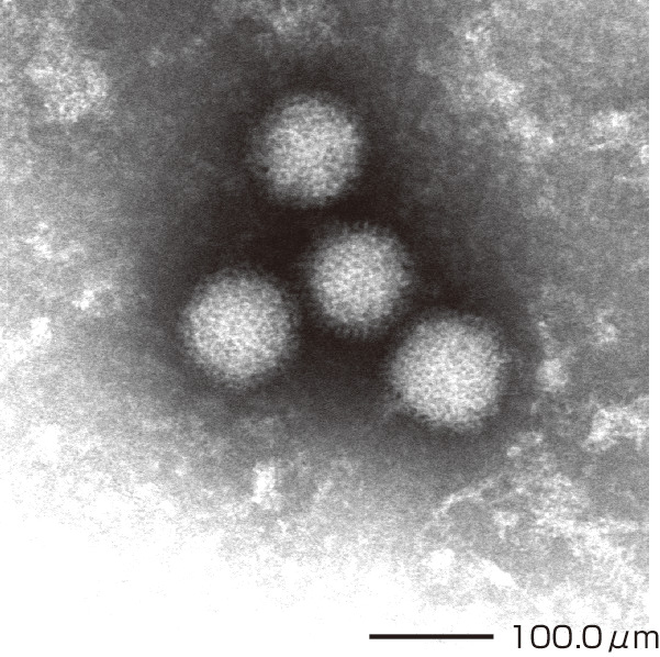 ⓔ図7-10-17　SFTSVの電子顕微鏡によるウイルス粒子 