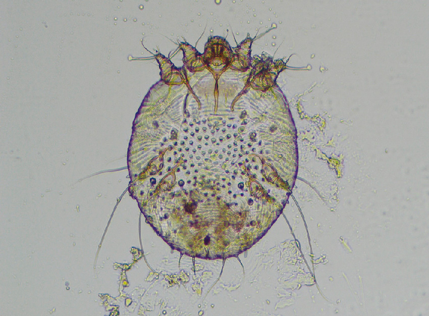 ⓔ図7-15-1　ヒゼンダニ (雌成虫) ヒゼンダニ成虫は0.2～0.4 mmで，皮膚角層内に生息する．