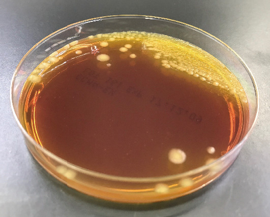 ⓔ図7-3-2　Clostridioides difficile 
