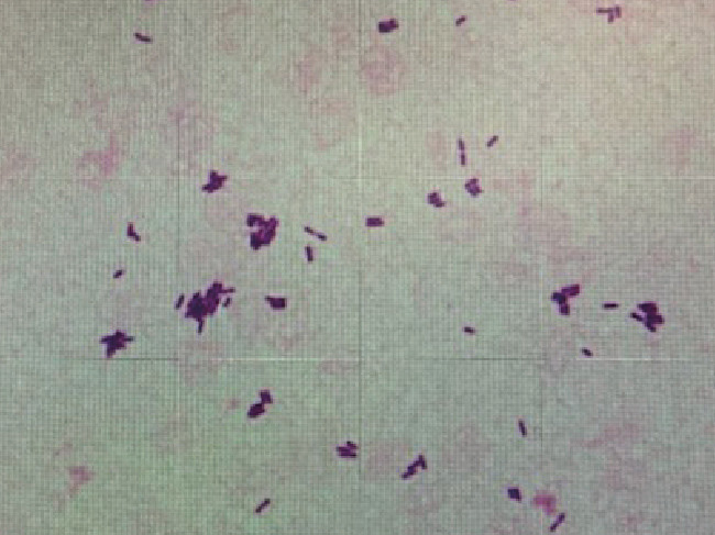 ⓔ図7-3-4　Listeria monocytogenes(Gram染色) 