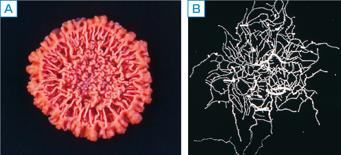 ⓔ図7-3-6　ノカルジアの顕微鏡所見 (症例提供：新潟大学医学部呼吸器感染症内科) コロニーは特徴的な “土臭” を発する菌糸状発育が観察される．