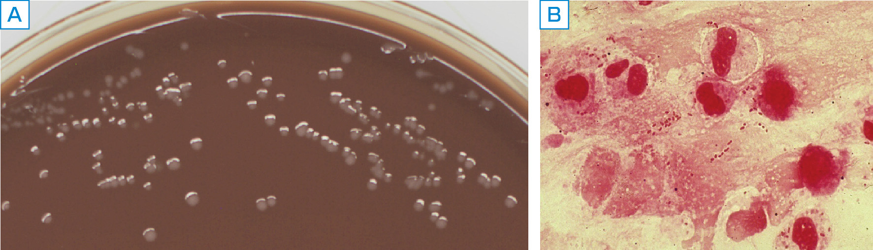 ⓔ図7-3-8　インフルエンザ菌のコロニー外観とGram染色所見 A：チョコレート寒天培地上のコロニー外観，B：Gram染色所見．