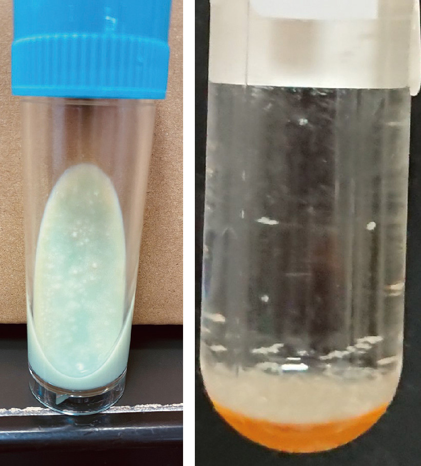 ⓔ図7-4-3　喀痰培養 左：小川培地に増殖した結核菌．白く斑状になったもの．実際には，ここから釣菌して，菌株同定を行う． 右：液体培地に増殖した結核菌．白く混濁した部分に結核菌が増殖している．しかし，検査室では，試験管は培養装置の中にある．結核菌が増殖し酸素が消費されると，試験管下部に設置されたセンサーが作動するようになっている．