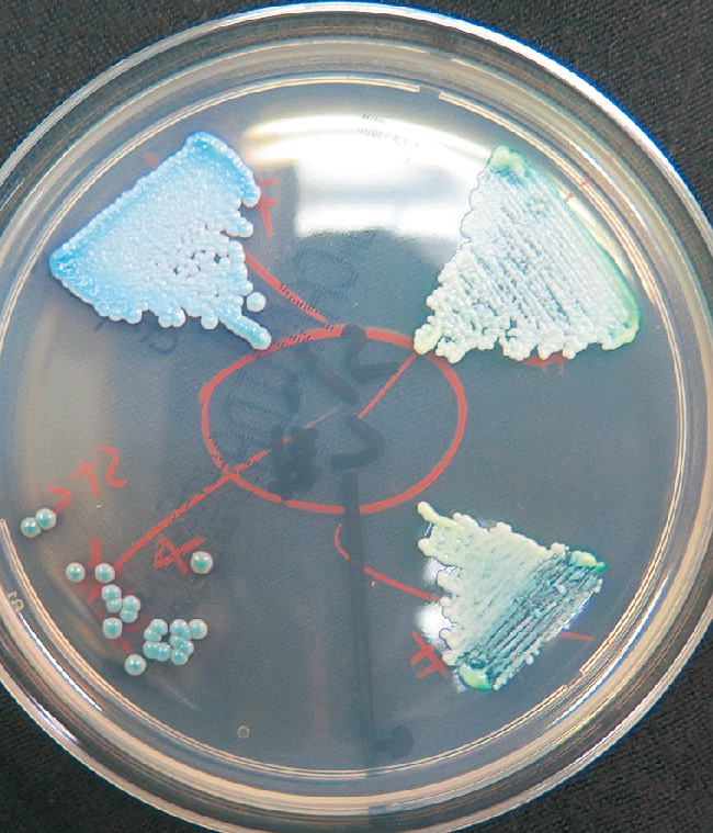 ⓔ図7-5-19　クロモアガーカンジダ培地での培養所見 青色の集落となるCandida tropicalisと緑色の集落となるCandida albicans．