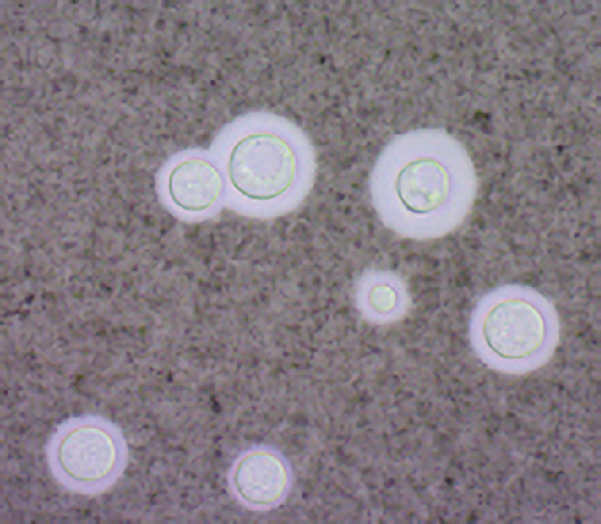 ⓔ図7-5-2　Cryptococcus neoformansの鏡検像 墨汁法で厚い莢膜を有する径5～20 μmの酵母細胞がみられる．
