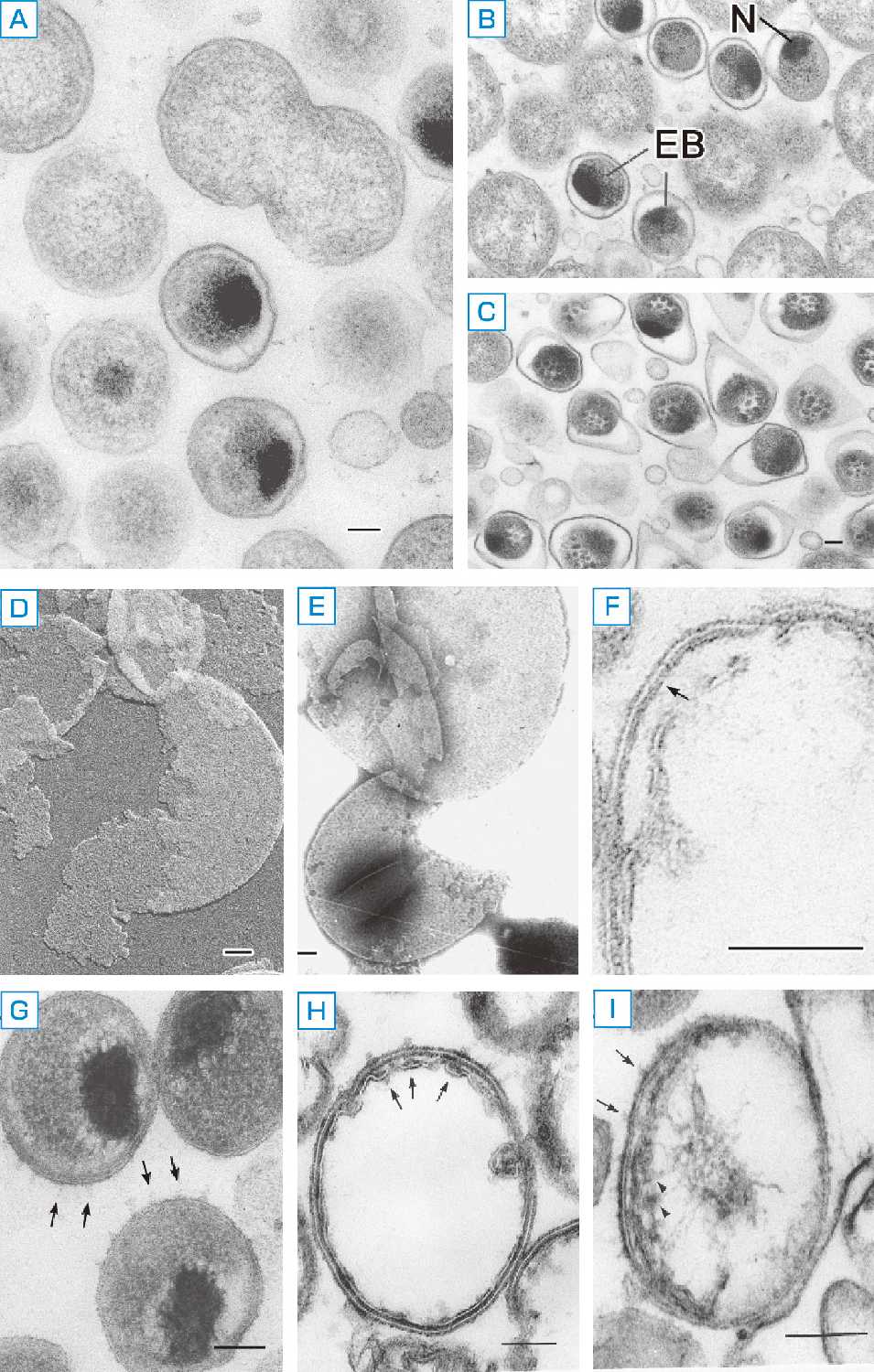 ⓔ図7-7-2　Chlamidophila pneumoniae菌体 クラミジア菌体の切片像 (A～C) と基本小体外膜のシャドウイング像 (D)，ネガティブ染色像 (E, F)．G～I：クラミジア菌体をルテニウム赤で増コントラスト処理した． スケールバーは0.1μm．基本小体外膜のシャドウイング像，ネガティブ染色像では六角網目状規則配列が染色液の浸透により外膜全体に認められる．矢印は表面突起を示す (G, I)．DNAが突起の部分に伸長している (Iの矢頭)．EB: elementary body (基本小体)，N: nucleus (核)
