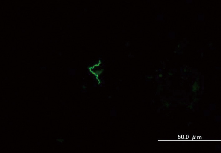 ⓔ図7-9-1　T. pallidumの蛍光顕微鏡写真 (×1000) (石原朋子：国立感染症研究所・細菌第一部) 