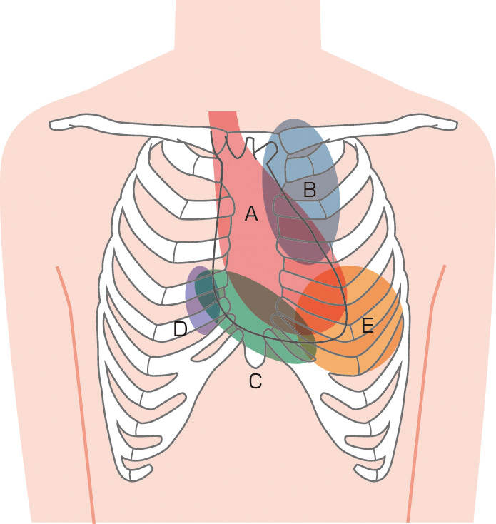 ⓔ図8-1-2　心音の聴診領域 A：大動脈弁領域，B：肺動脈弁領域，C：右室，D：右房，E：僧帽弁領域．