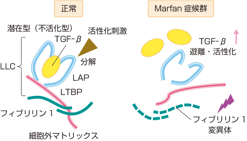 ⓔ図8-15-1　Marfan症候群の病態生理 フィブリリン1はTGF–β の活性化を抑制的に制御している (左)．Marfan症候群では，フィブリリン1の量的・質的な異常に伴って，TGF–β が恒常的に活性化している．