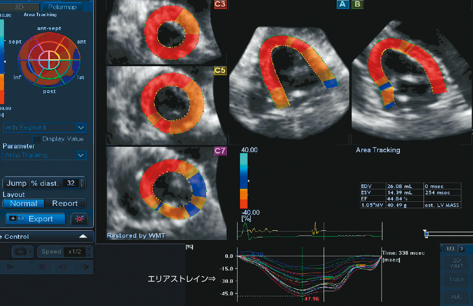 ⓔ図8-5-14　三次元スペックルトラッキング法により求めたエリアストレイン (イヌの心臓) 
