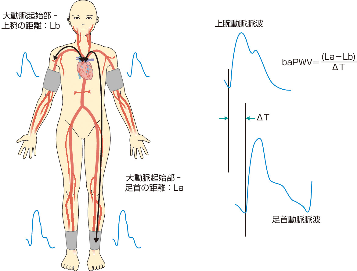 ⓔ図9-2-12　上腕–足首間脈波伝播速度 (baPWV) の測定法 