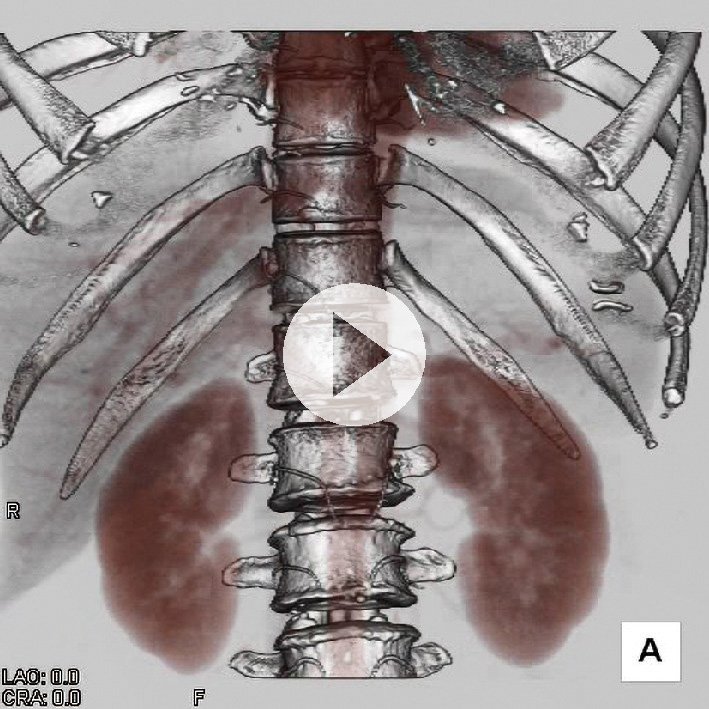 ⓔ動画12-1-1　腹部臓器と脈管の三次元画像  https://vimeo.com/657267680/3ff0f0e133