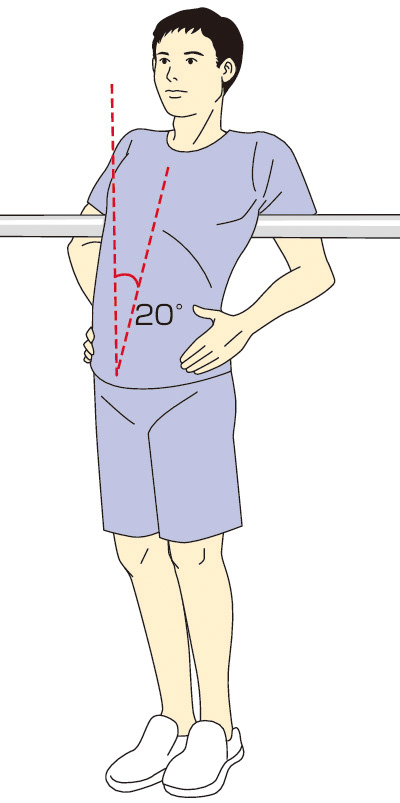 図1　前弯負荷試験． 