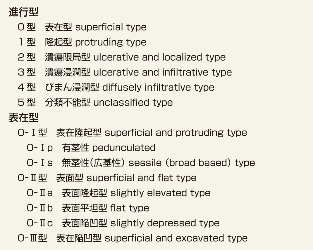 ⓔ表11-3-2　食道癌の病型分類 