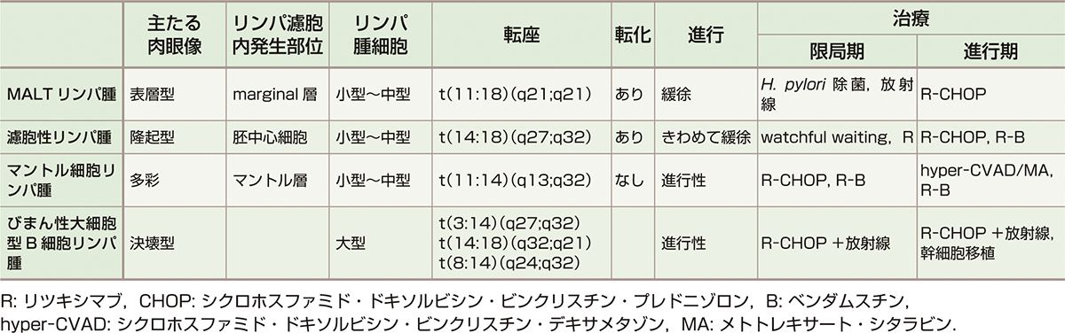 ⓔ表11-4-1　胃リンパ腫の特徴像 