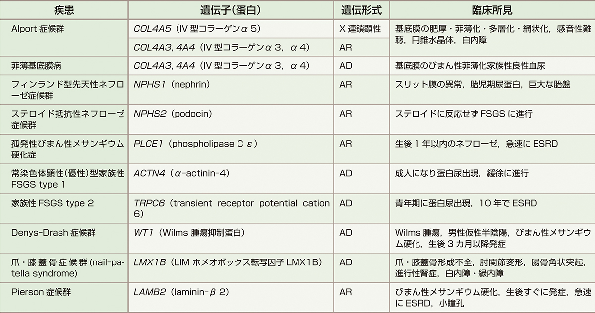 ⓔ表14-4-3　ネフローゼ症候群をきたす遺伝子異常 