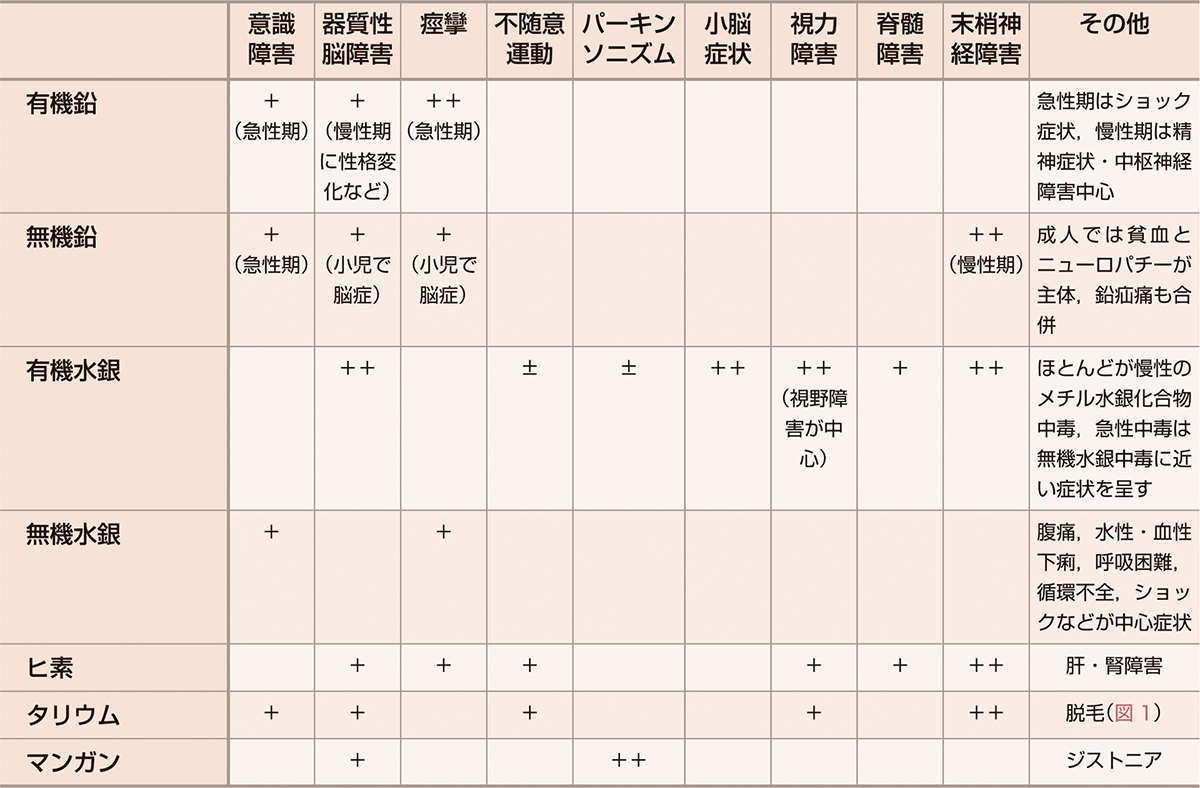 ⓔ表18-11-1a　重金属による神経系障害 