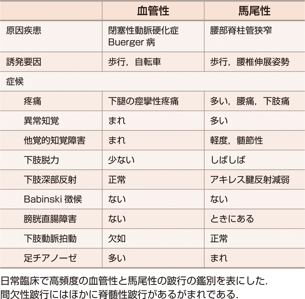 ⓔ表18-18-2　間欠性跛行の症候の相違 